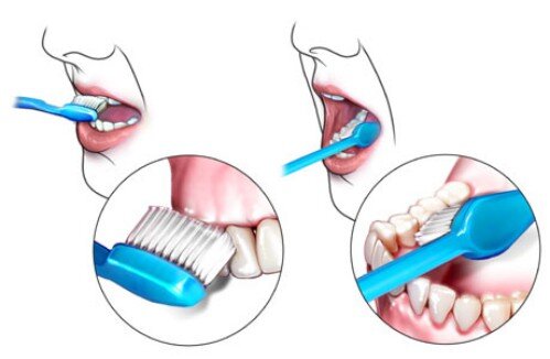 Cách chăm sóc răng nhạy cảm mỗi ngày