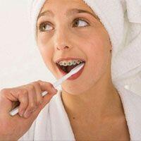 Chỉnh hình răng - chỉnh nha là gì?
