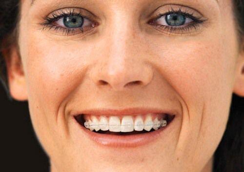 răng xấu ảnh hưởng tới sức khỏe