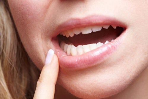 răng xấu ảnh hưởng tới sức khỏe