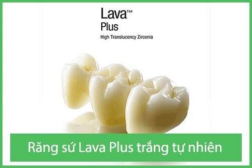 Bọc răng sứ Lava Plus giá bao nhiêu tiền ? 2