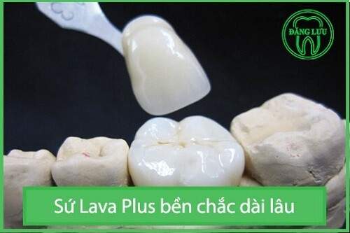 Bọc răng sứ Lava Plus giá bao nhiêu tiền ? 3