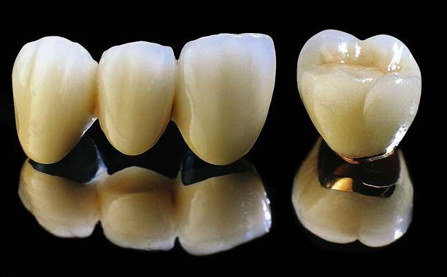 Cách làm răng đều đẹp tự nhiên CỰC NHANH CHÓNG!! 1