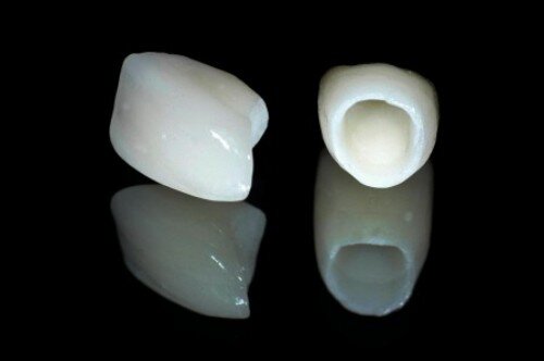 Phục hình răng sứ không kim loại