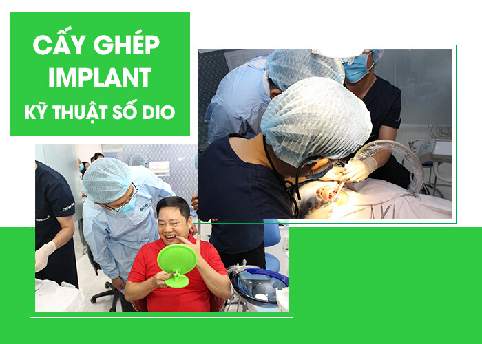 Dịch vụ cấy ghép implant tại trung tâm nha khoa