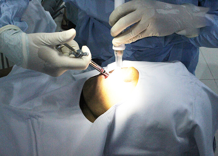 cấy ghép Implant