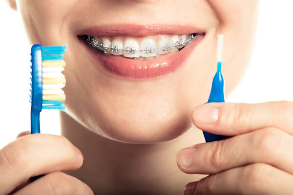 chế độ ăn uống hợp lý khi niềng răng