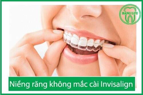 Chi phí niềng răng không mắc cài invisalign bao nhiêu tiền? 1