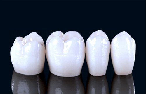 Có nên bọc răng sứ Zirconia cho răng cửa hay không?