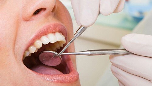 Chảy máu chân răng là biểu hiện của bệnh gì? 3