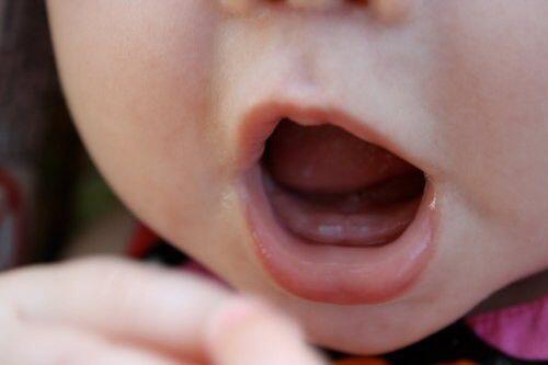 Trẻ chậm mọc răng