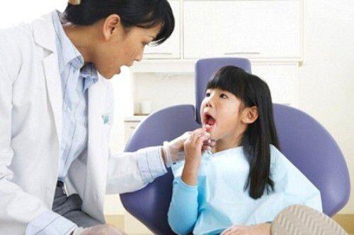 Những thắc mắc thường gặp khi chăm sóc răng trẻ em