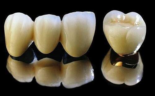 Răng sứ là gì ? 2