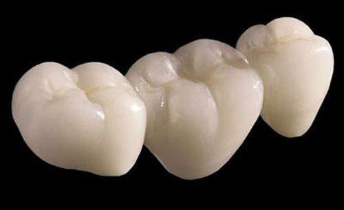 Các loại vật liệu phục vụ phẫu thuật trám răng
