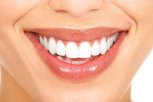 Tẩy trắng răng bằng phương pháp chiếu đèn kết hợp thuốc tẩy 1