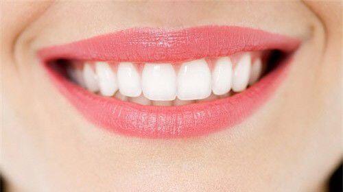 Tẩy trắng răng thế nào để đẹp và an toàn