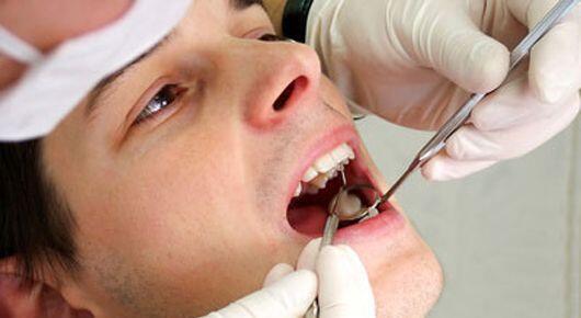 Trám răng cho tình trạng thiếu sản men răng
