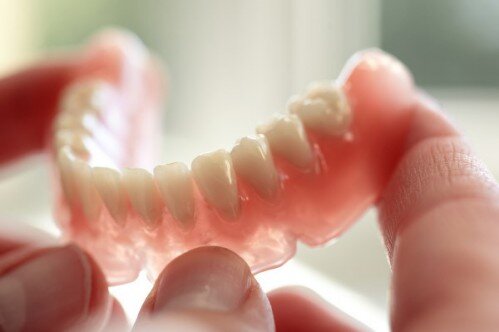 Yếu tố giúp gắn chặt răng giả bền bỉ