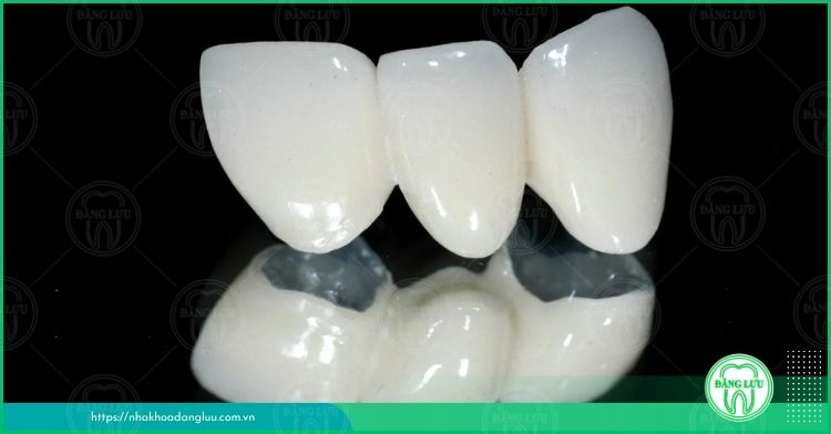 Thiết kế răng sứ bằng công nghệ 3D