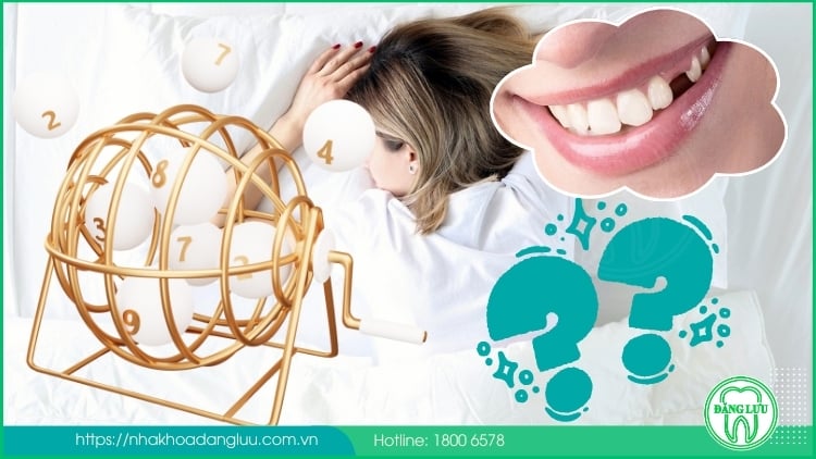 Mơ thấy gãy răng đánh số gì cùng công ty chiếc 789BET - Bí quyết lời giải giấc mơ và tăng may mắn chiến thắng trong lô đề