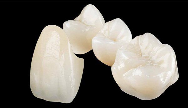 Bạn biết gì về bọc răng sứ Cercon? - Nha Khoa Đăng Lưu-1