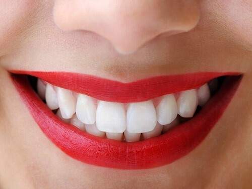 Bao lâu nên tẩy trắng răng một lần ? 3