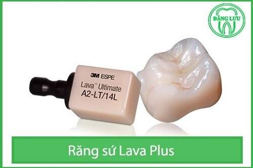 Bọc răng sứ Lava Plus giá bao nhiêu tiền ? 1