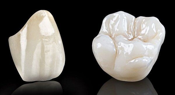  Cách chăm sóc răng sứ Titan để tăng tuổi thọ răng sứ-1