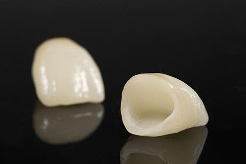 Cách chăm sóc răng sứ Zirconia để tăng tuổi thọ răng sứ