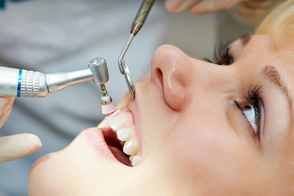 Làm gì để phòng ngừa sự hình thành cao răng hiệu quả?-1