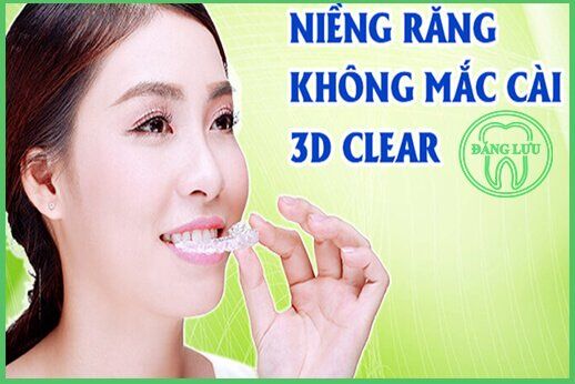 Clear 3D niềng răng