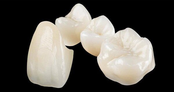 Có nên bọc răng sứ Titan cho răng hàm bị sâu hay không?