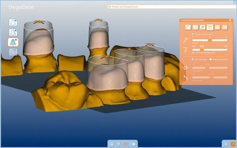 Kỹ thuật CAD/CAM trong nha khoa là gì?