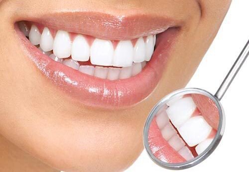 Lựa chọn liệu trình tẩy trắng răng phù hợp