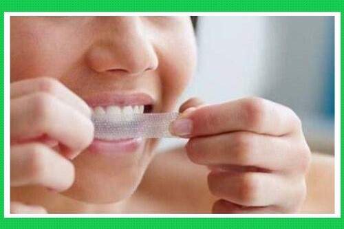 Miếng dán tẩy trắng răng có thật sự tốt? 1