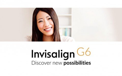 Những ưu điểm nổi bật của niềng răng Invisalign G6