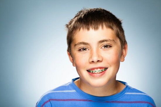 Niềng răng cho trẻ em ở đâu tốt tại tphcm?