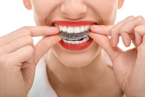 Hội thảo về phương pháp niềng răng không mắc cài 3D-1