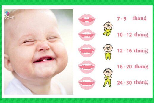 Quá trình mọc răng ở trẻ em-1