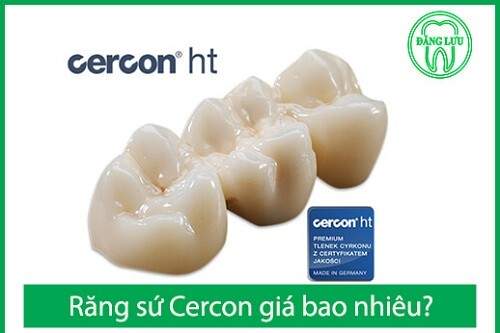 Răng sứ Cercon giá bao nhiêu ? 1