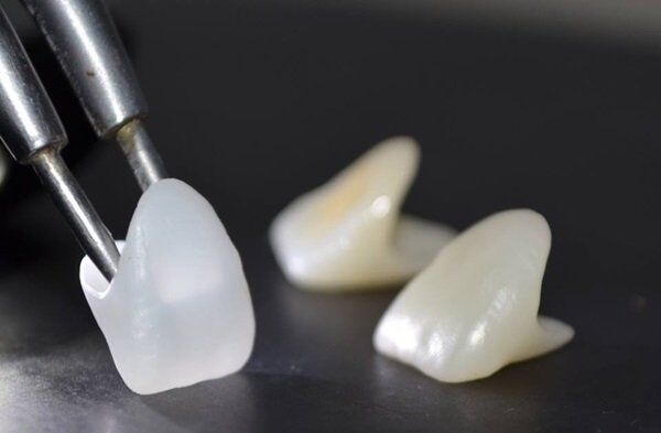 Bọc răng sứ không kim loại Cercon HT giá bao nhiêu tiền?
