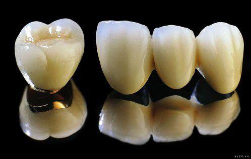 Những lý do tại sao răng toàn sứ lại mắc?-1