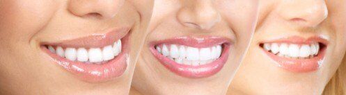 Tuổi tác ảnh hưởng tới việc tẩy trắng răng
